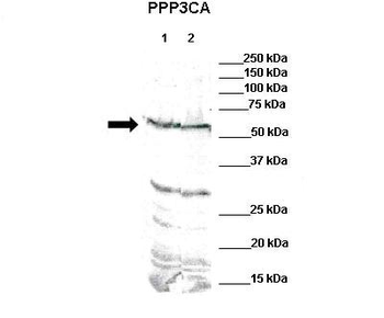 PPP3CA antibody