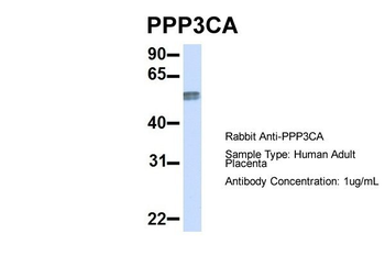 PPP3CA antibody