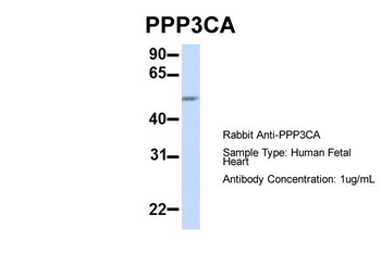 PPP3CA antibody