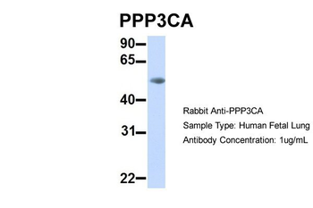 PPP3CA antibody