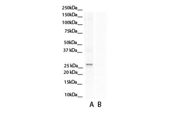 ASPH antibody