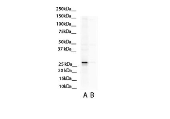ASPH antibody