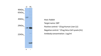 DBT antibody