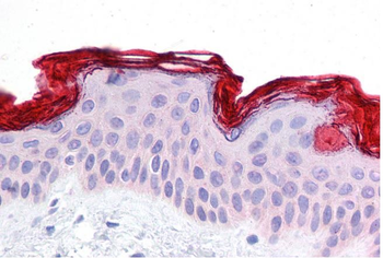 DBT antibody