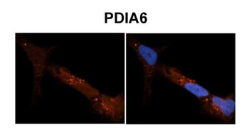 PDIA6 antibody