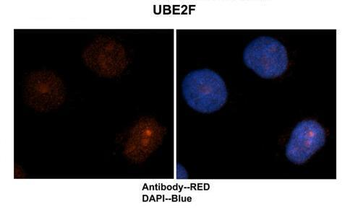 UBE2F antibody