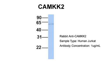 CAMKK2 antibody