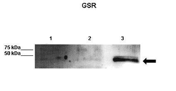 GSR antibody