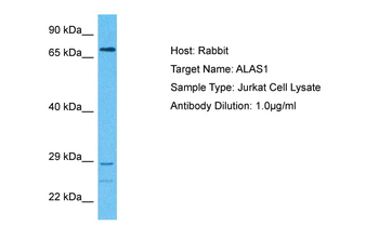 ALAS1 antibody