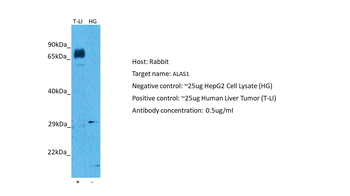 ALAS1 antibody