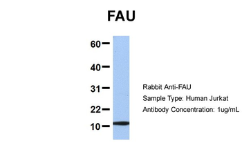 FAU antibody