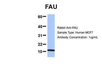 FAU antibody