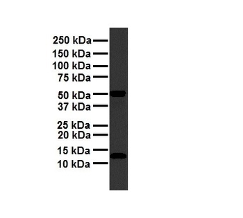 FAU antibody