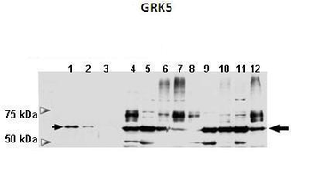 GRK5 antibody