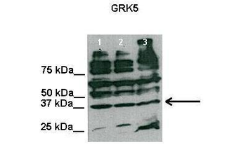 GRK5 antibody