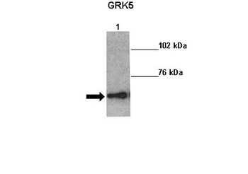 GRK5 antibody