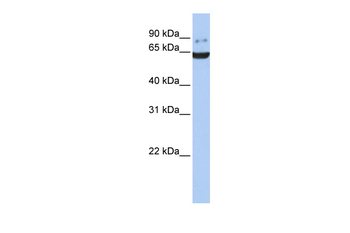 GRK5 antibody