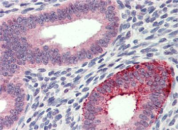 FCHO1 antibody