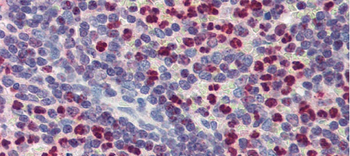 FCHO1 antibody