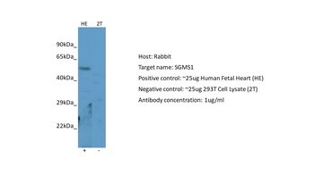 SGMS1 antibody