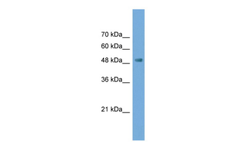 NPTX2 Rabbit Polyclonal Antibody