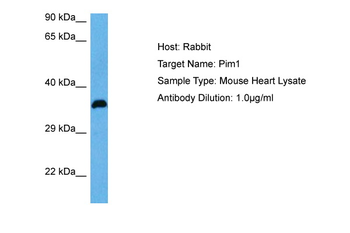 PIM1 antibody