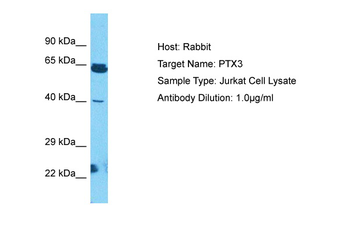 PTX3 antibody