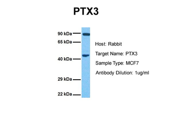 PTX3 antibody