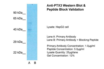 PTX3 antibody