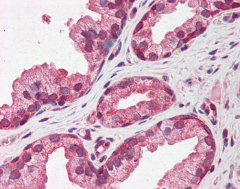 PTX3 antibody