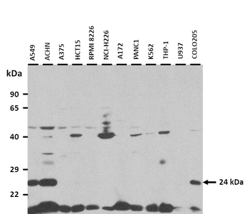 RAB5B antibody