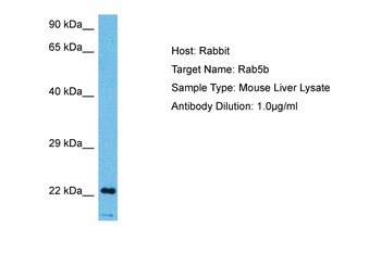 RAB5B antibody