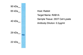 RAB1A antibody