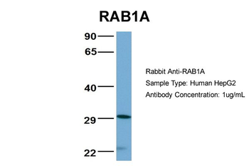 RAB1A antibody