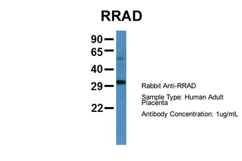 RRAD antibody