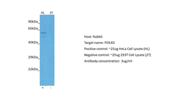 PDE4D antibody