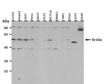 CRBN Rabbit Polyclonal Antibody