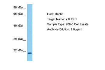 YTHDF1 antibody