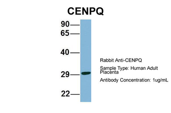 CENPQ antibody