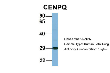 CENPQ antibody
