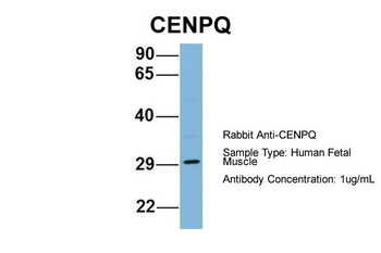 CENPQ antibody