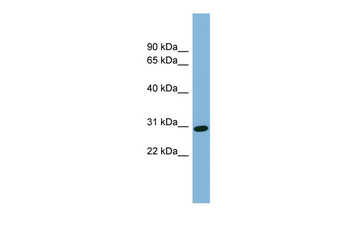 CENPQ antibody