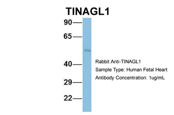 TINAGL1 antibody