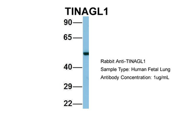 TINAGL1 antibody