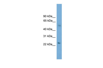 BBS4 antibody