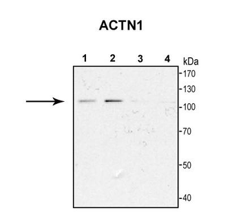 ACTN1 antibody