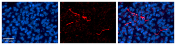 CPE antibody