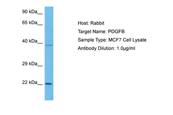 PDGF B antibody