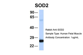 SOD2 antibody