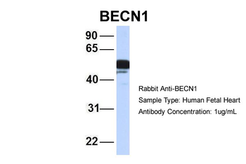 Beclin 1 antibody